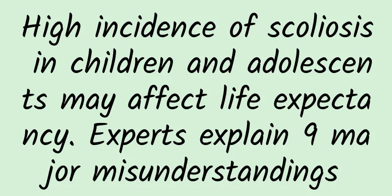 High incidence of scoliosis in children and adolescents may affect life expectancy. Experts explain 9 major misunderstandings