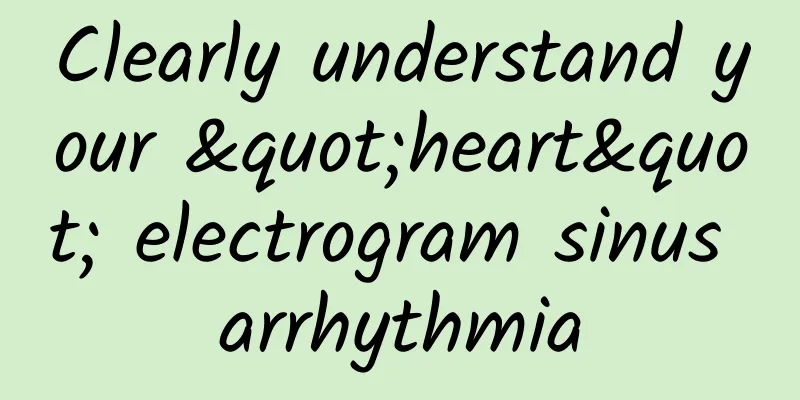 Clearly understand your "heart" electrogram sinus arrhythmia