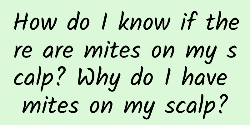 How do I know if there are mites on my scalp? Why do I have mites on my scalp?